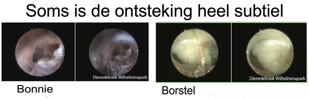 Er is pus achter het trommelvlies te zien 